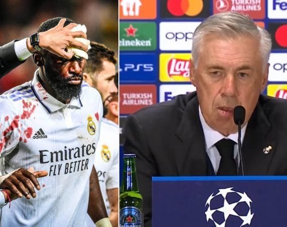 rudiger-recibe-20-puntos-de-sutura-tras-sufrir-corte-en-la-cara-y-ancelotti-revela-su-estado:-‘‘queria-seguir-jugando…’’